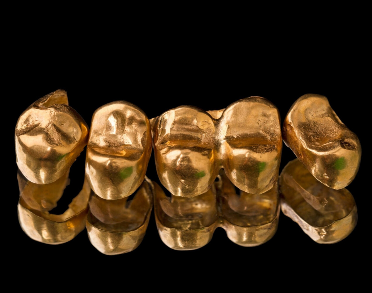 Скупка  стоматологического золота в Брянске
